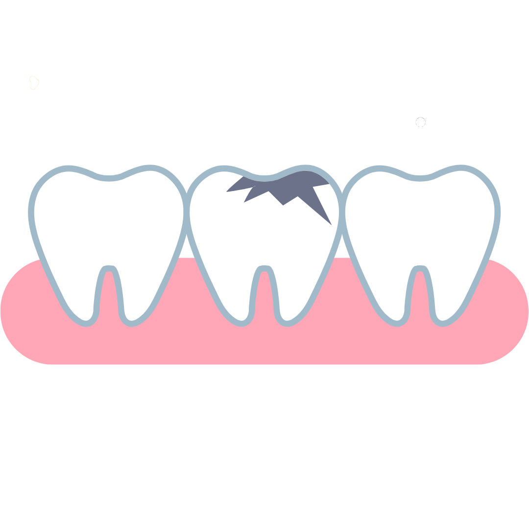 むし歯になりやすい人の特徴は?今日から見直せる生活習慣チェック