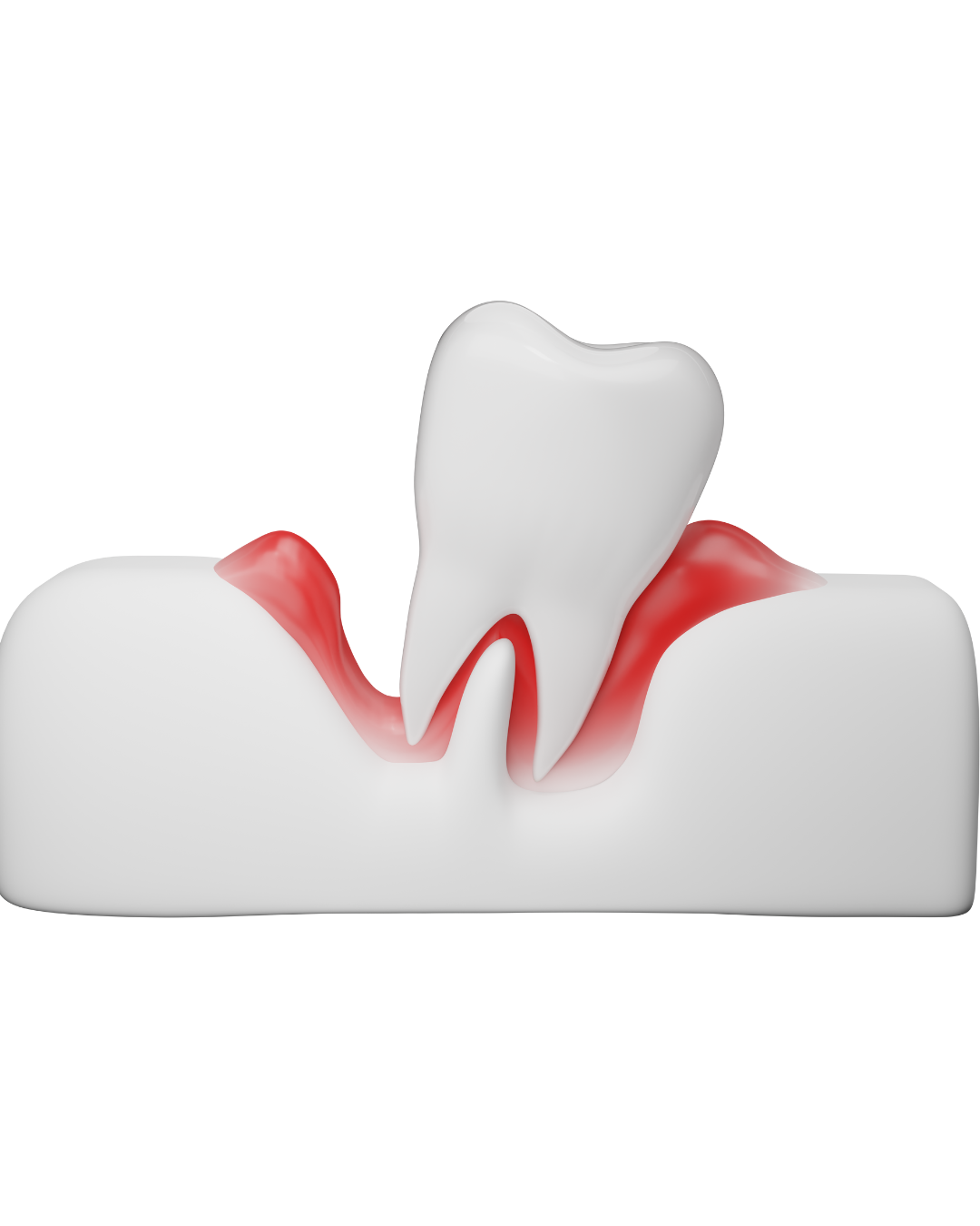 気づかないうちに進行する歯周病！生活習慣が与える影響とは？