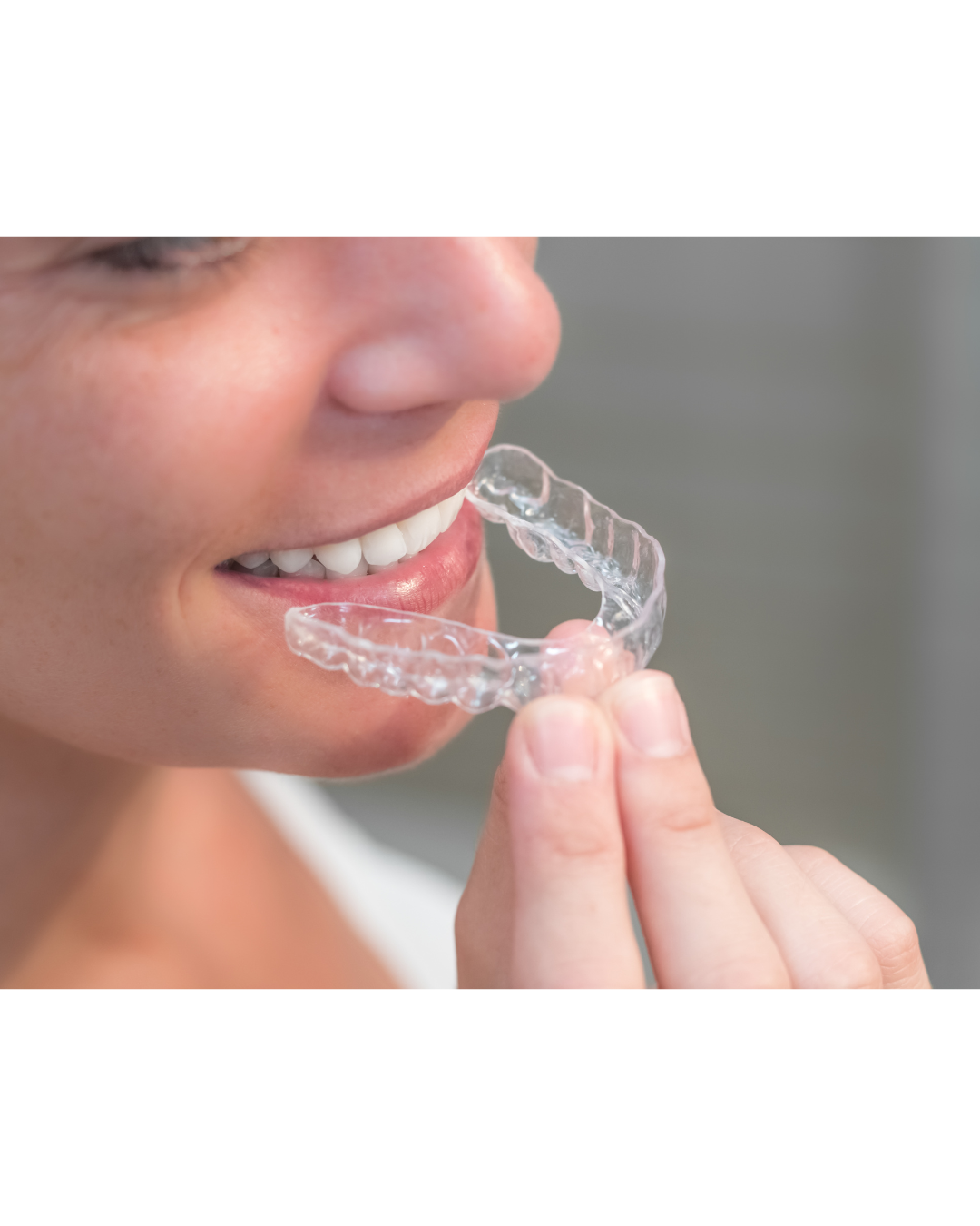 矯正治療が順調に進む人に共通する5つのポイント